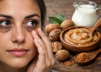 Dark Circles Under Your Eyes? Try This Easy Nutmeg Remedy