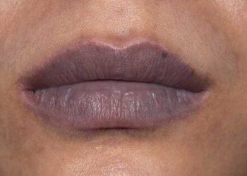 Dark Lips Explained: It’s Not Just Tea, It’s Your Daily Habits