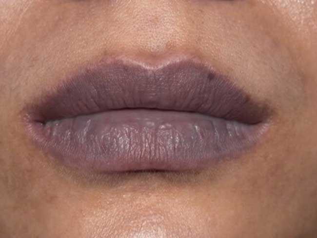 Dark Lips Explained: It’s Not Just Tea, It’s Your Daily Habits